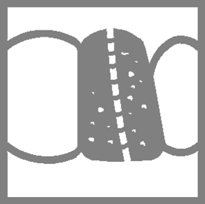 Course à la couronne